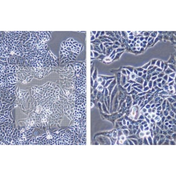 人肺巨细胞癌细胞PLA801D