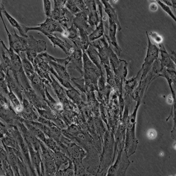 小鼠鳞状细胞癌细胞带荧光素酶SCC7/LUC