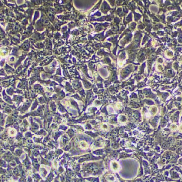 荧光素酶/GFP标记的KM小鼠脑神经胶质母细胞瘤株G422/LUC/GFP