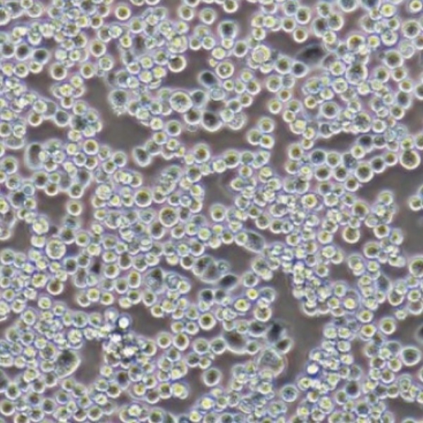 人慢性粒细胞白血病细胞NALM1