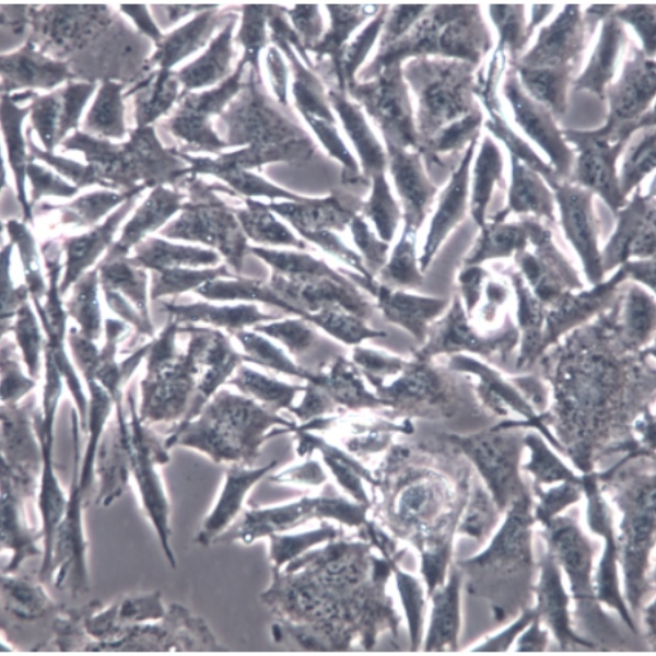 人甲状腺癌细胞SW579