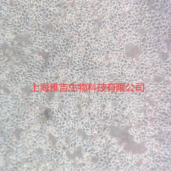 人套细胞淋巴瘤细胞Granta519