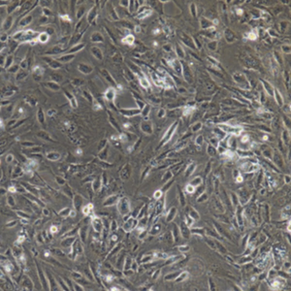 人肾上腺皮质细腺癌细胞NCIH295R