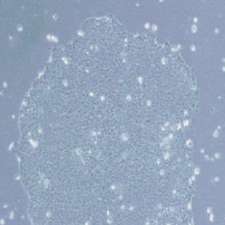 人非小细胞肺癌细胞A549/GFP/LUC