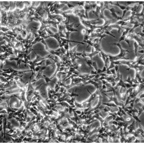 人血管成纤维细胞GM00882