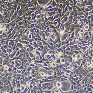 人胃癌细胞黄色荧光标记HGC27YFP