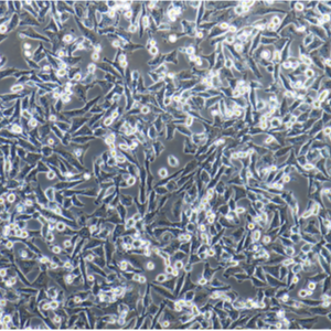 人卵巢癌细胞A2780/GFP