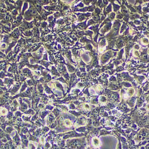 人Burkkit淋巴瘤细胞带荧光素酶Daudi/LUC