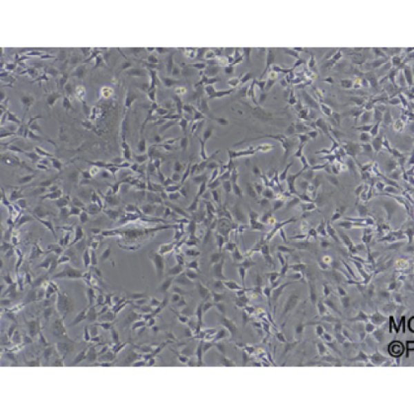 荧光素酶标记的人软骨肉瘤细胞SW1353/LUC