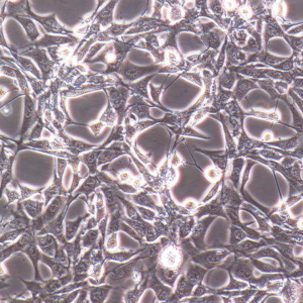 人胚胎心脏成纤维样细胞HEH2