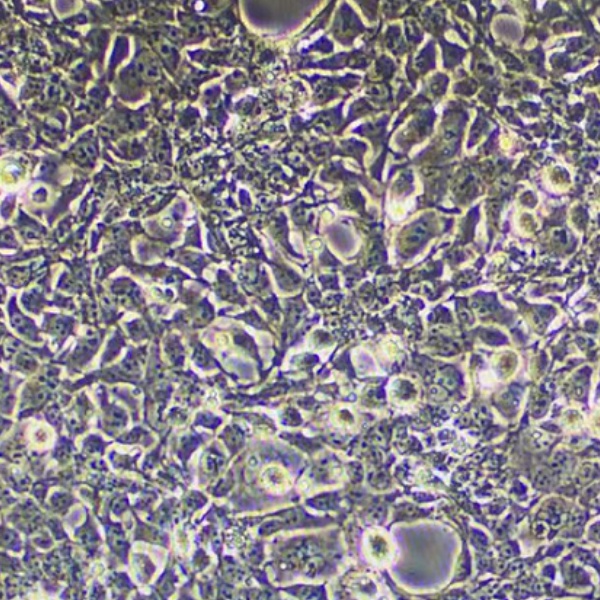 人非小细胞肺癌细胞A549/GFP/LUC