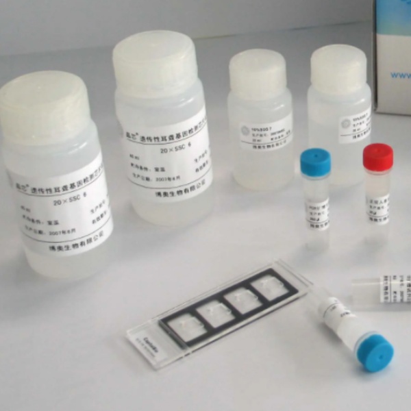 人纤调蛋白(fibromodulin)Elisa试剂盒