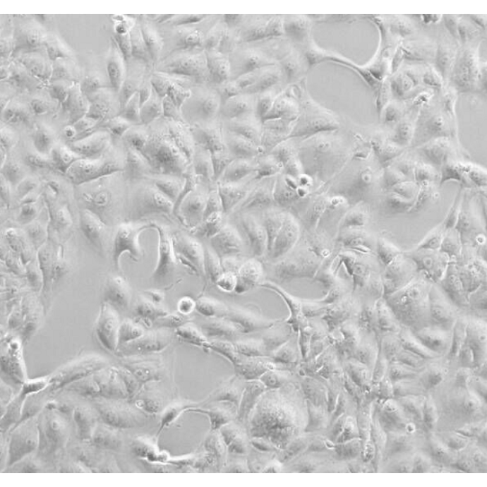 人肺腺癌细胞Calu3