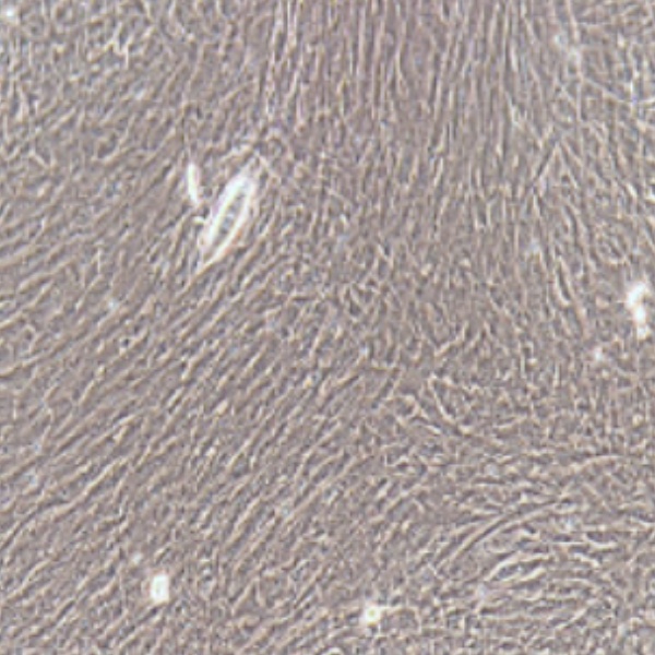 人类急性髓系白血病细胞ME1