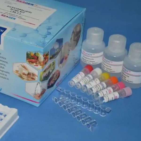 大鼠血管生成素4(ANG-4)Elisa试剂盒