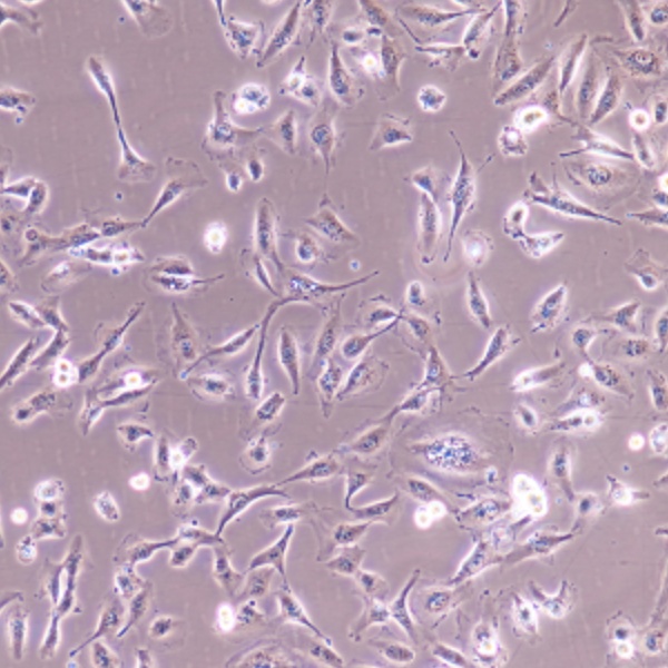 人包皮微血管内皮细胞有限细胞系HMEC1