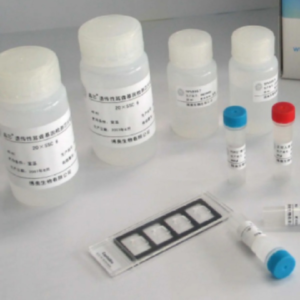 猴弓形虫Elisa抗体Elisa试剂盒(TOXAb)