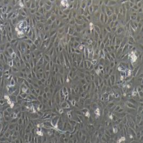 人肾癌细胞SN12PM6