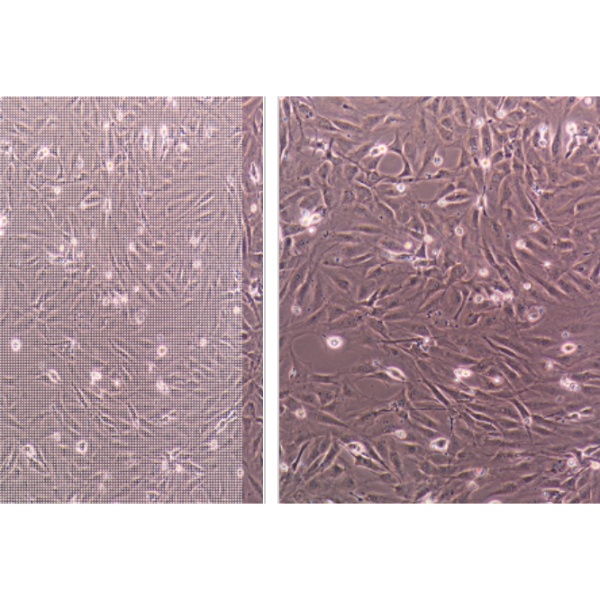人膀胱癌细胞EJ-1