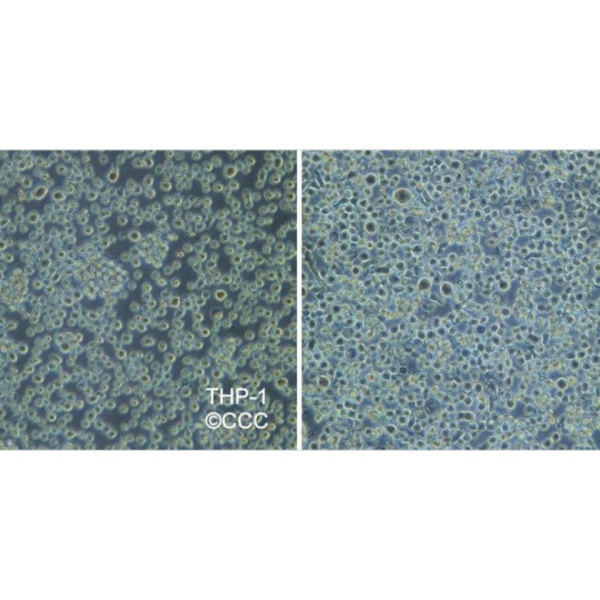 小鼠（骨髓瘤）杂交瘤细胞IGG-6A6