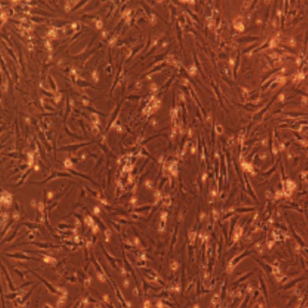 人弥漫大B淋巴瘤细胞-荧光素酶标记HBL-1/LUC-PURO