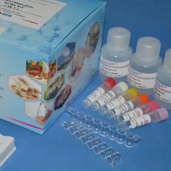 人钙联蛋白(CNX)Elisa试剂盒
