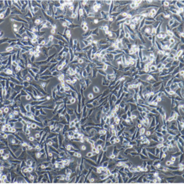 人肺巨细胞癌细胞(低转移)95C