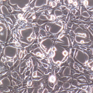 人胶质母细胞瘤细胞A172 