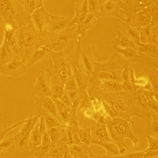 人视网膜色素上皮细胞HRPEpiC