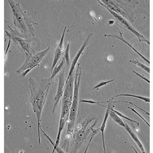 人胰腺癌细胞Capan1