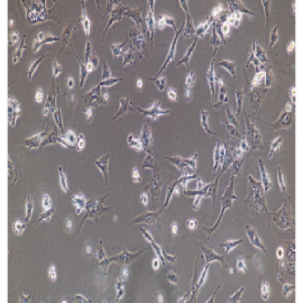 人急性淋巴细胞白血病细胞CEMC1