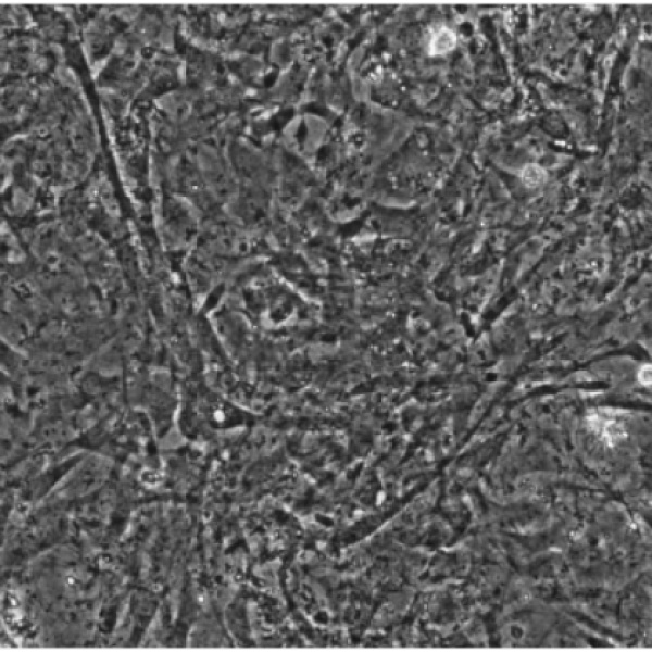 人口腔鳞状细胞癌细胞HN13