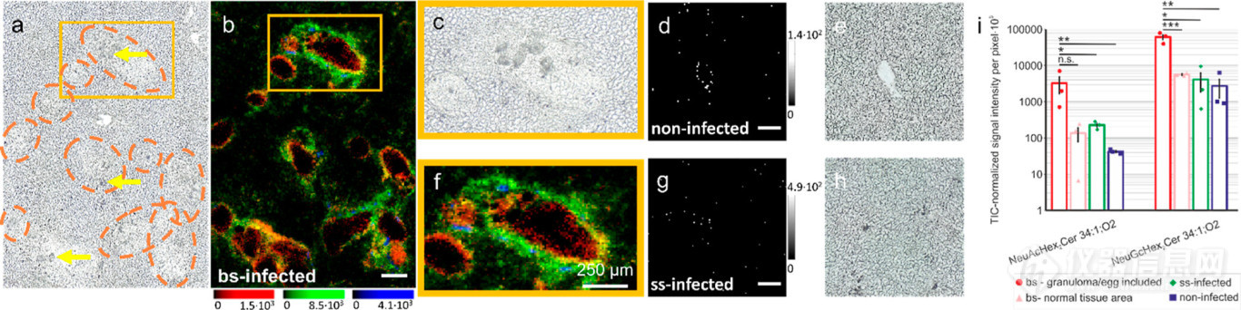 利用AP-SMALDI质谱成像和nano-HILIC MS揭示曼氏血吸虫感染后仓鼠肝脏鞘糖脂变化