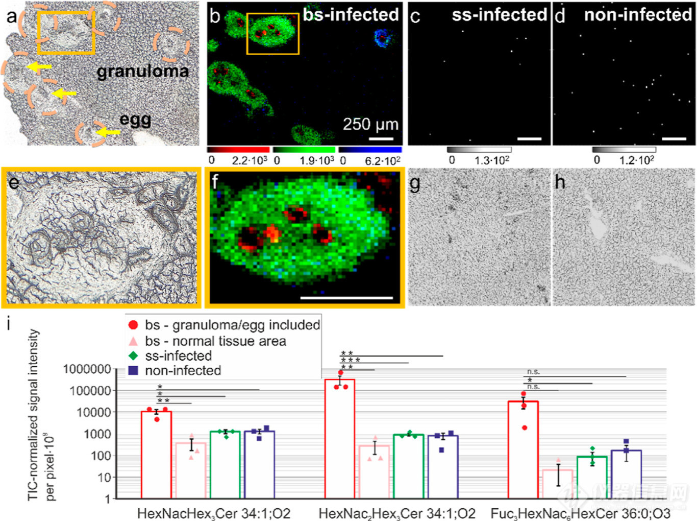 利用AP-SMALDI质谱成像和nano-HILIC MS揭示曼氏血吸虫感染后仓鼠肝脏鞘糖脂变化