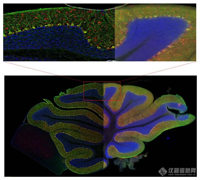 超快光学层切全景扫描系统-奥林巴斯-新品