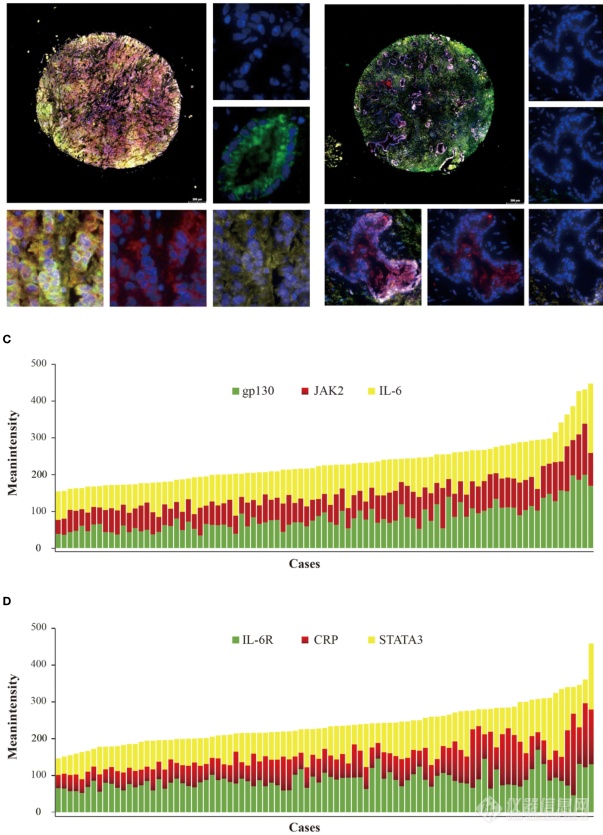 Tissue Cytometry技术为胆管癌相关IL-6信号通路的多组学可视化研究提供策略