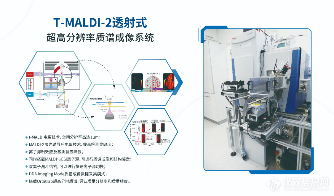 利用AP-SMALDI质谱成像和nano-HILIC MS揭示曼氏血吸虫感染后仓鼠肝脏鞘糖脂变化