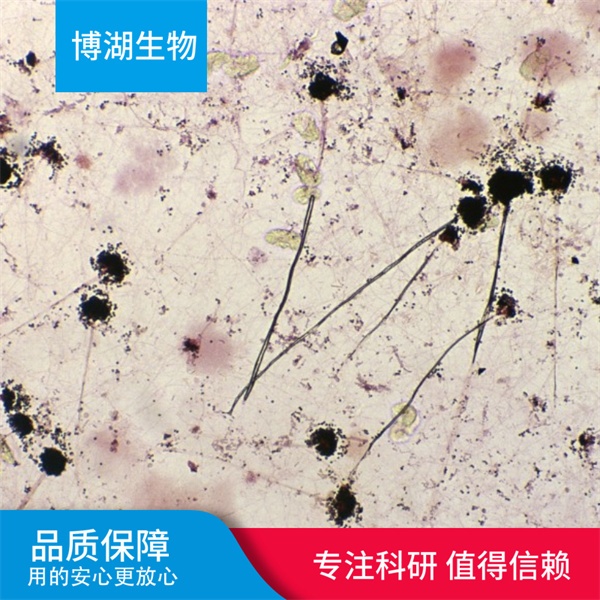 ES-2人卵巢透明细胞癌细胞