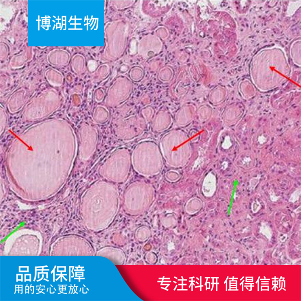 MFC小鼠前胃癌细胞