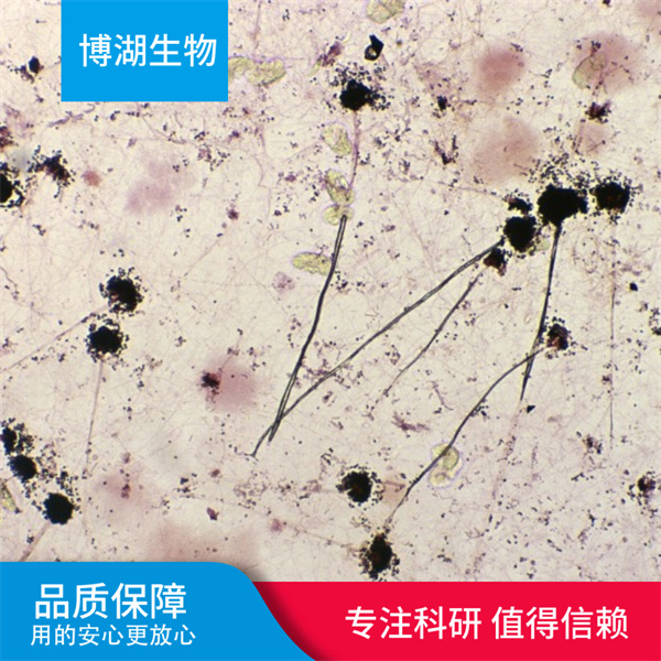 C6+LUC大鼠脑胶质瘤细胞绿色荧光标记