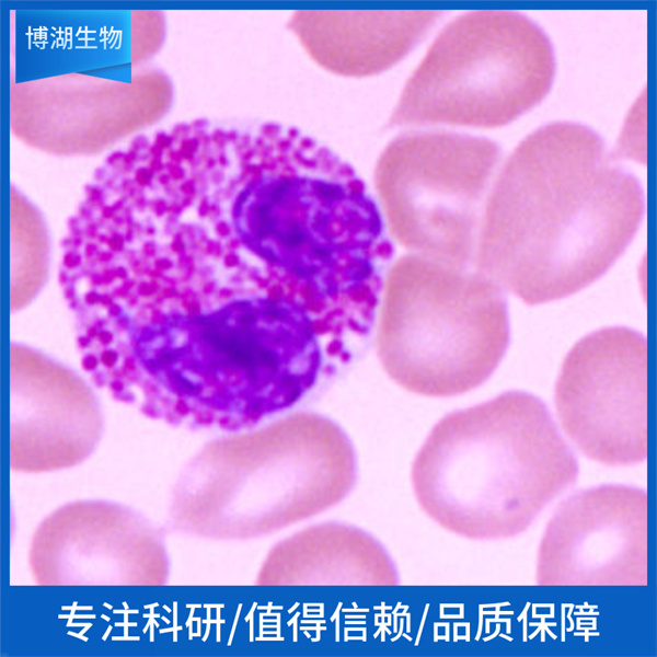 MDA-MB-453人乳腺癌细胞