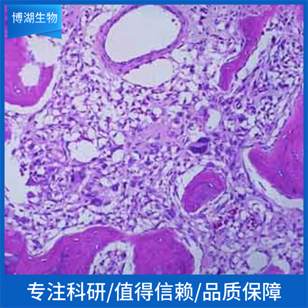 MDA-MB-453人乳腺癌细胞