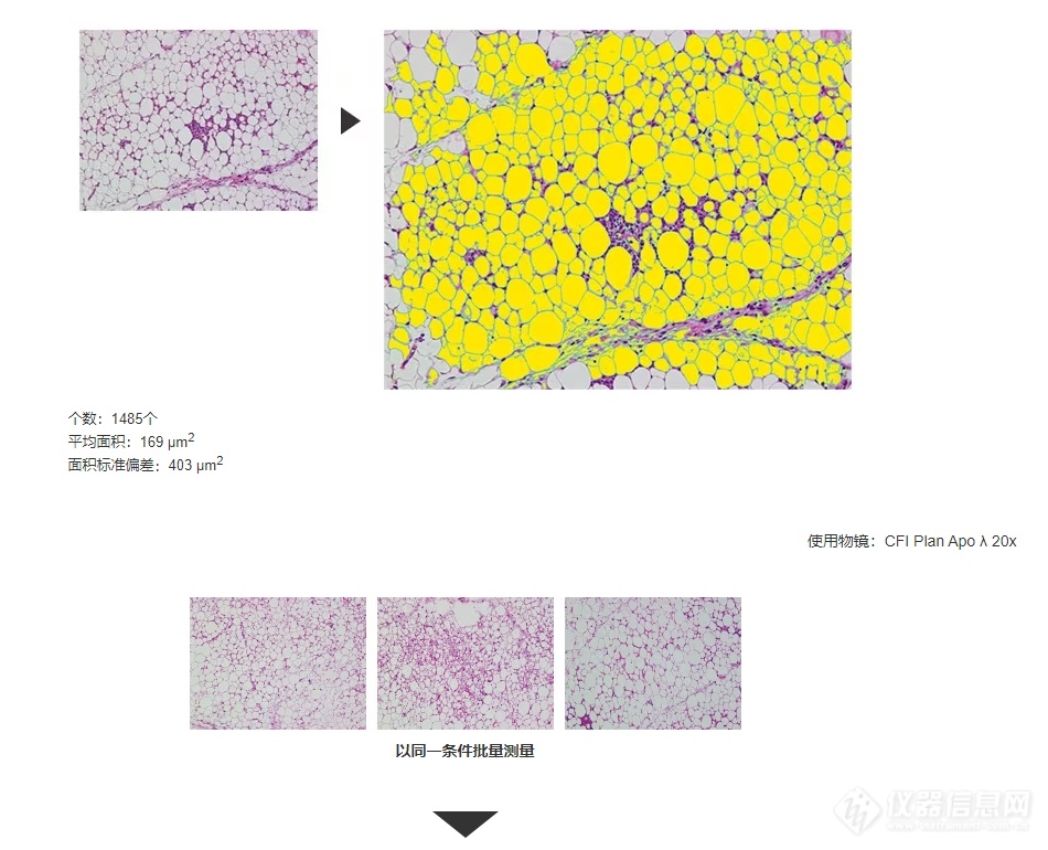 脂肪细胞的定量分析