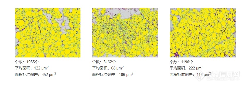 脂肪细胞的定量分析