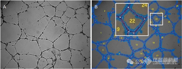 血管生成实验数据怎么分析，这些秘诀您都知道么？