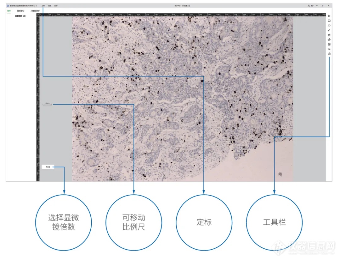 新品发布│E慧眼智能显微镜驱动中国数字病理市场变革