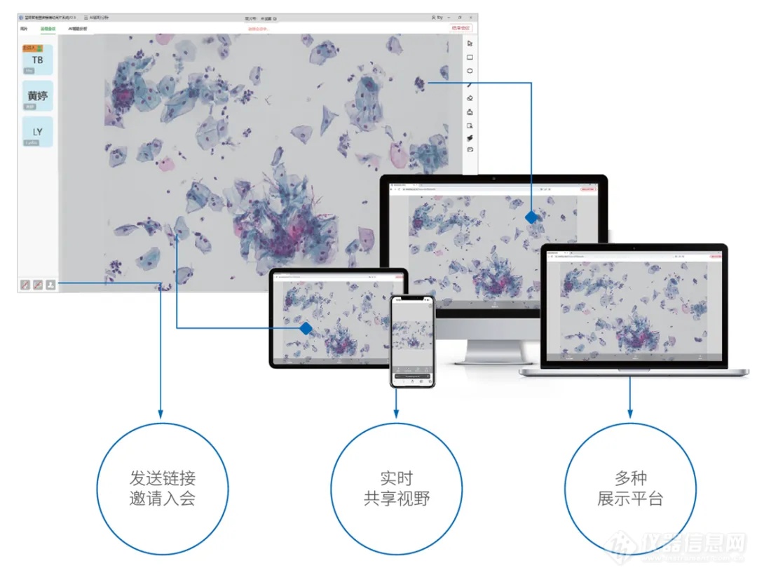 新品发布│E慧眼智能显微镜驱动中国数字病理市场变革