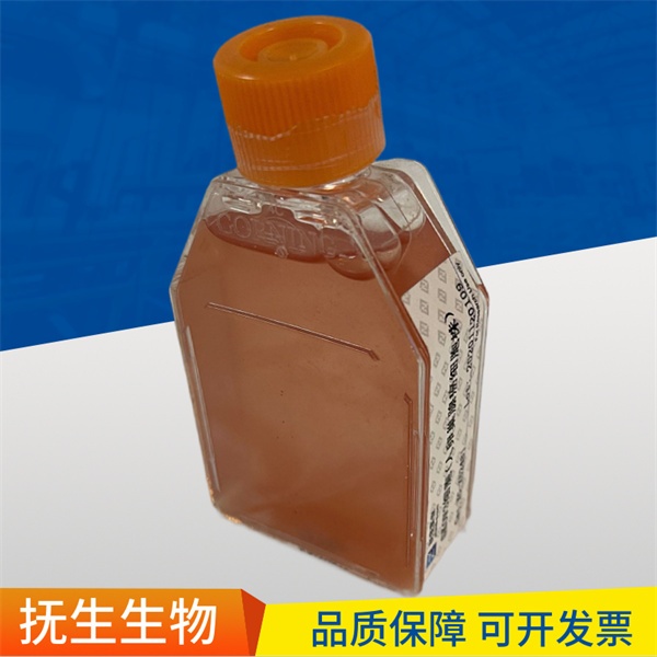 ZR-75-1人乳腺导管癌细胞