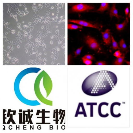 HCC95 人肺腺癌细胞 QCH768