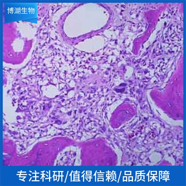 CMK-11-5急性髓性白血病细胞